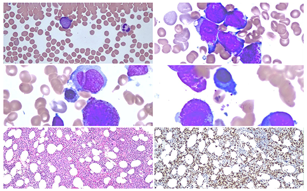 Students in class listening to a lecturer